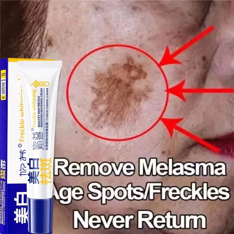 Powerful Spot-Removing Whiten  - огляд і ціна Skincare Korea