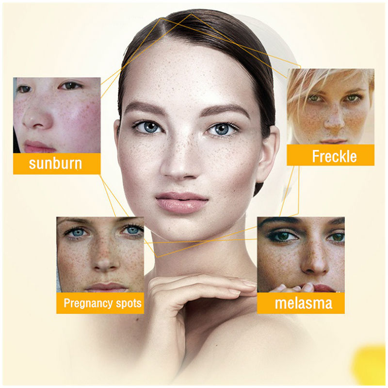 Dimollaure Whitening Freckle C - огляд і ціна Skincare Korea