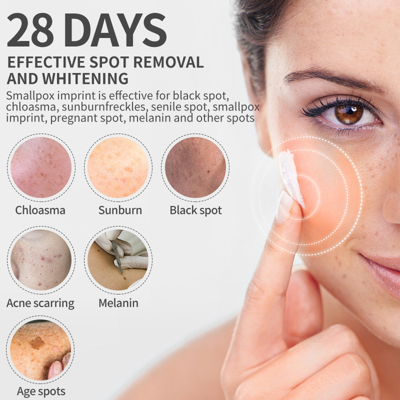 Dimollaure Whitening Freckle C - огляд і ціна Skincare Korea