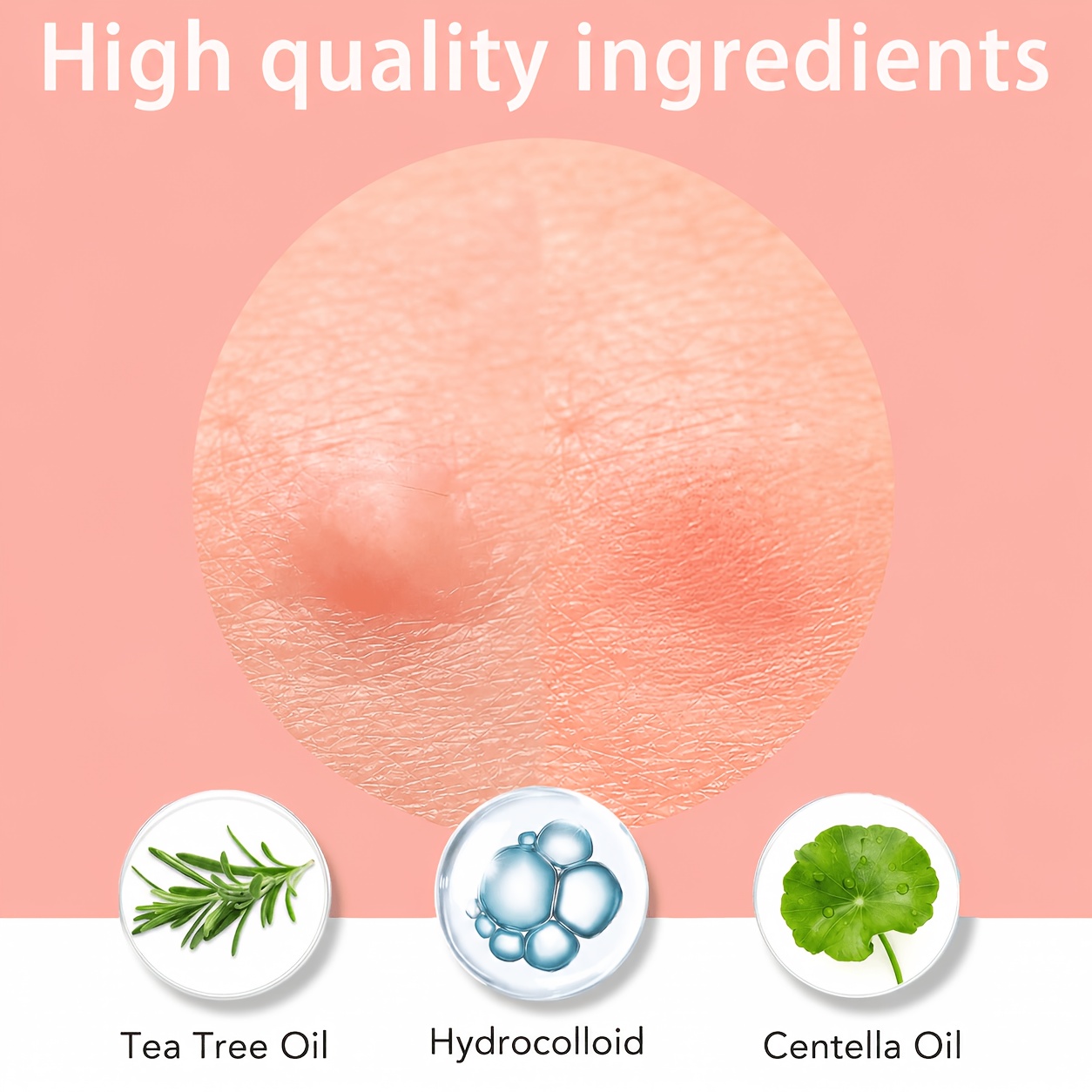 1200/400pcs/box invisible acne - огляд і ціна Skincare Gentle